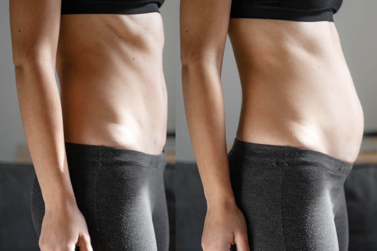 How long does diastasis recti take to improve Hastings?