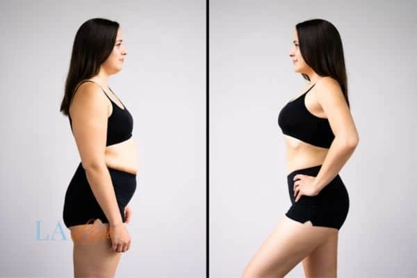 Picture of womans before and after using LA-EMS body sculpting to improve her core strength Hastings